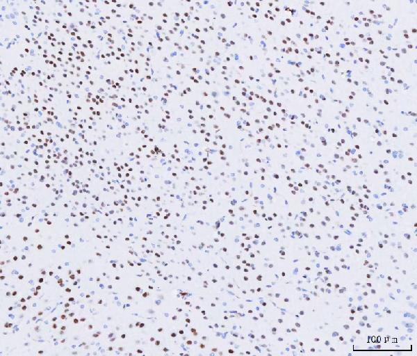 2 - Anti-MEF2A+MEF2C Rabbit Monoclonal Antibody ABO14109
