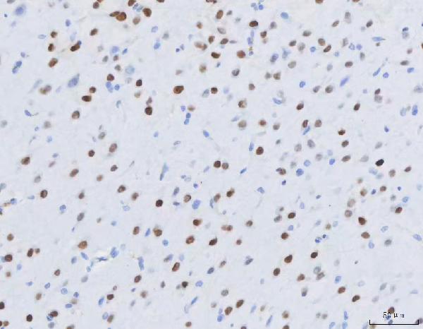 2 - Anti-MEF2A+MEF2C Rabbit Monoclonal Antibody ABO14109