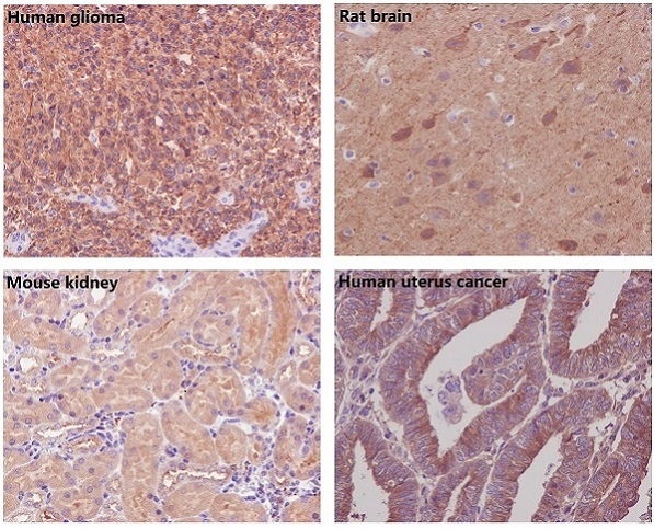 2 - Anti-beta Tubulin TUBB Rabbit Monoclonal Antibody ABO14110