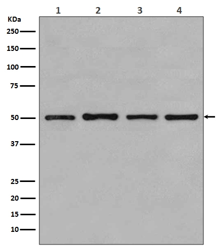 1 - Anti-beta Tubulin TUBB Rabbit Monoclonal Antibody ABO14110