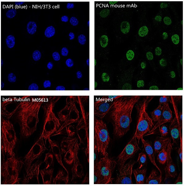 3 - Anti-beta Tubulin TUBB Rabbit Monoclonal Antibody ABO14110