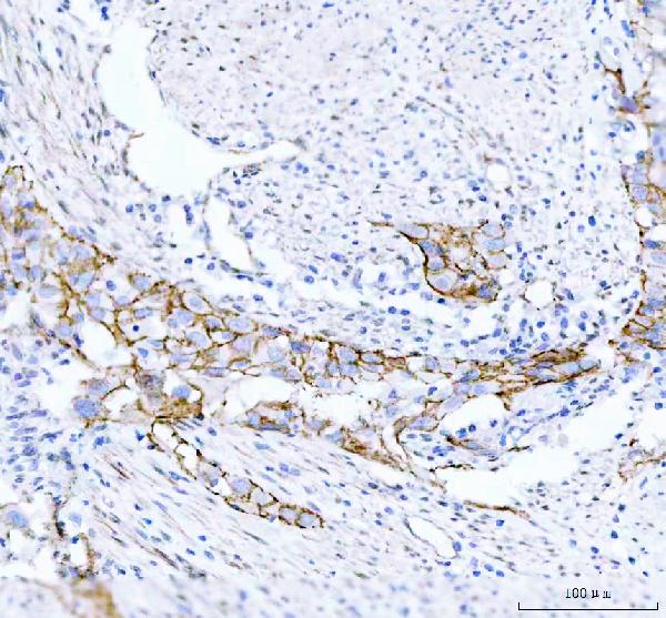 2 - Anti-beta Catenin CTNNB1 Rabbit Monoclonal Antibody ABO14111