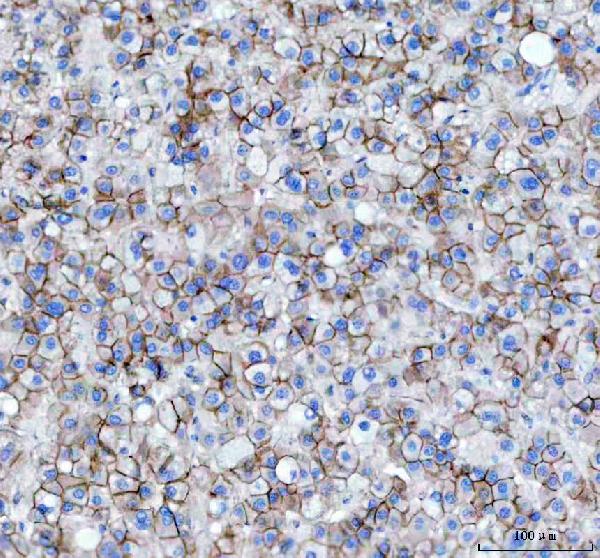 2 - Anti-beta Catenin CTNNB1 Rabbit Monoclonal Antibody ABO14111