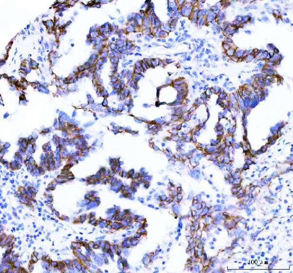 2 - Anti-beta Catenin CTNNB1 Rabbit Monoclonal Antibody ABO14111