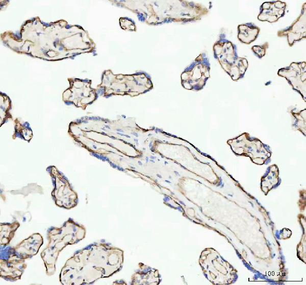 2 - Anti-beta Catenin CTNNB1 Rabbit Monoclonal Antibody ABO14111