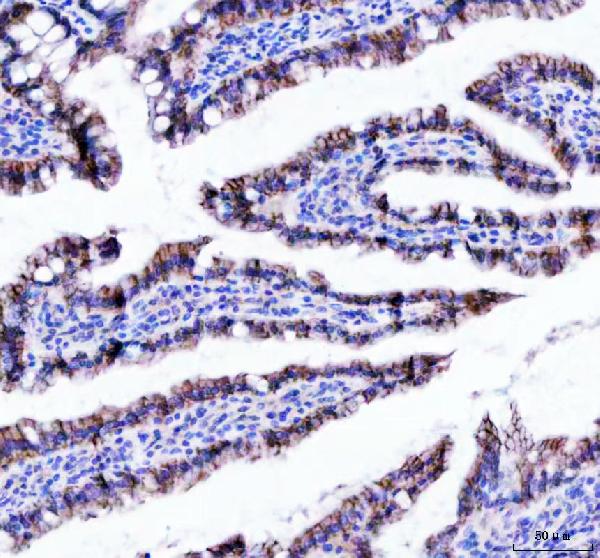 2 - Anti-beta Catenin CTNNB1 Rabbit Monoclonal Antibody ABO14111