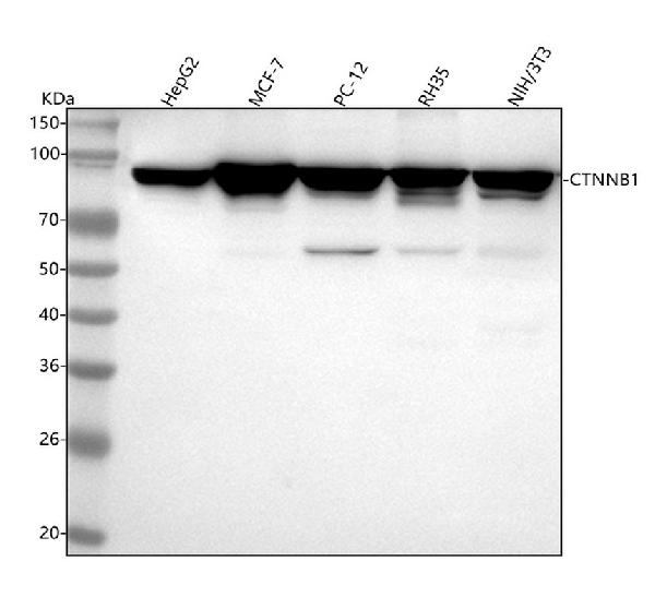 1 - Anti-beta Catenin CTNNB1 Rabbit Monoclonal Antibody ABO14111
