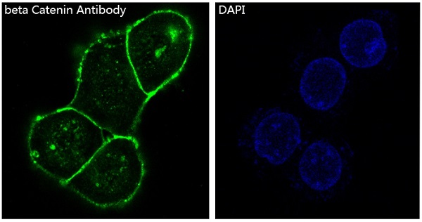 3 - Anti-beta Catenin CTNNB1 Rabbit Monoclonal Antibody ABO14111