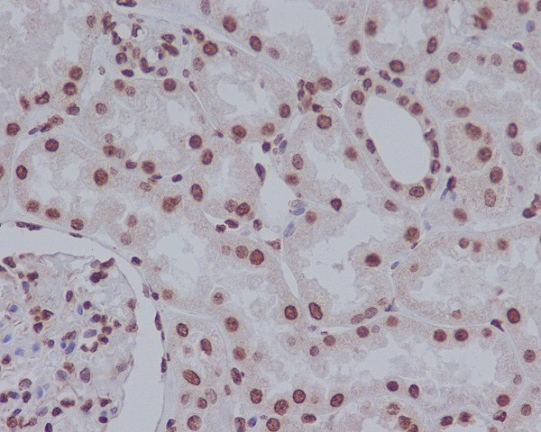 2 - Anti-Cleaved PARP PARP1 Rabbit Monoclonal Antibody ABO14112