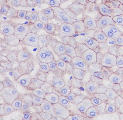2 - Anti-LDL Receptor Rabbit Monoclonal Antibody ABO14113