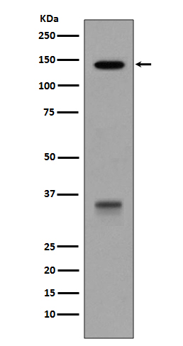 1 - Anti-LDL Receptor Rabbit Monoclonal Antibody ABO14113