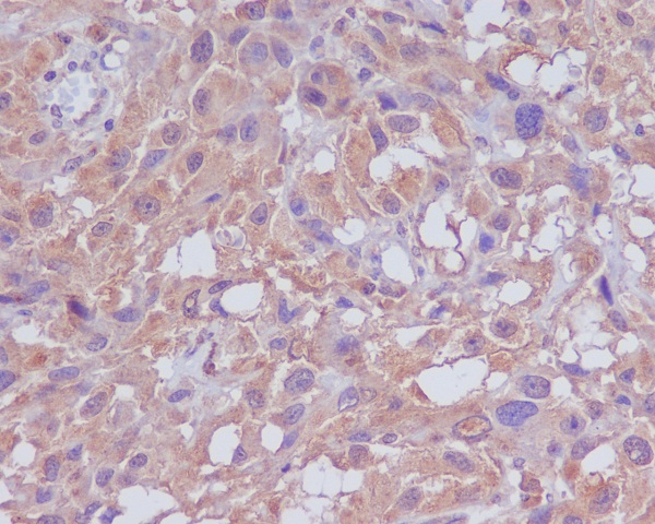 2 - Anti-Neuropilin 1 NRP1 Rabbit Monoclonal Antibody ABO14114