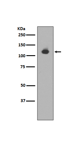 1 - Anti-Neuropilin 1 NRP1 Rabbit Monoclonal Antibody ABO14114