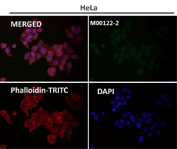 1 - Anti-Cleaved PARP PARP1 Rabbit Monoclonal Antibody ABO14115