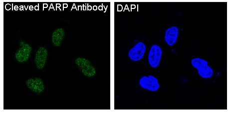 3 - Anti-Cleaved PARP PARP1 Rabbit Monoclonal Antibody ABO14115