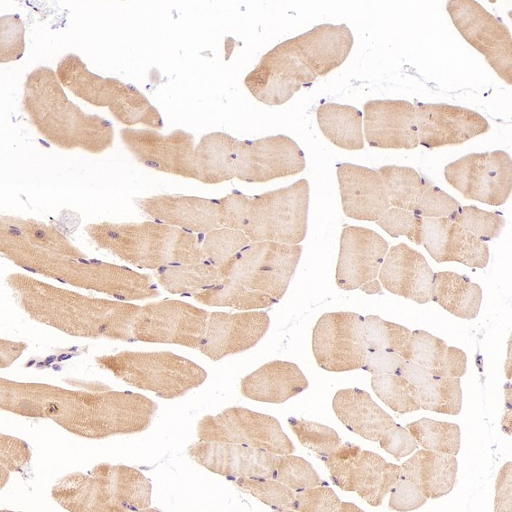 2 - Anti-Cleaved PARP PARP1 Rabbit Monoclonal Antibody ABO14115