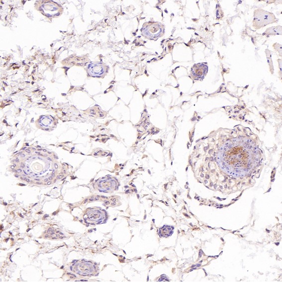 2 - Anti-Cleaved PARP PARP1 Rabbit Monoclonal Antibody ABO14115