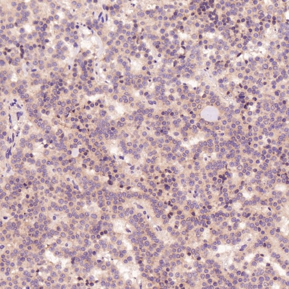 2 - Anti-Cleaved PARP PARP1 Rabbit Monoclonal Antibody ABO14115