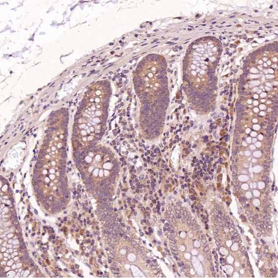 2 - Anti-Cleaved PARP PARP1 Rabbit Monoclonal Antibody ABO14115