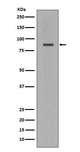 1 - Anti-Cleaved PARP PARP1 Rabbit Monoclonal Antibody ABO14115