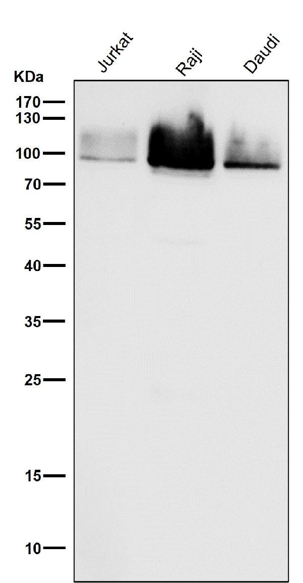 1 - Anti-Cleaved PARP PARP1 Rabbit Monoclonal Antibody ABO14115
