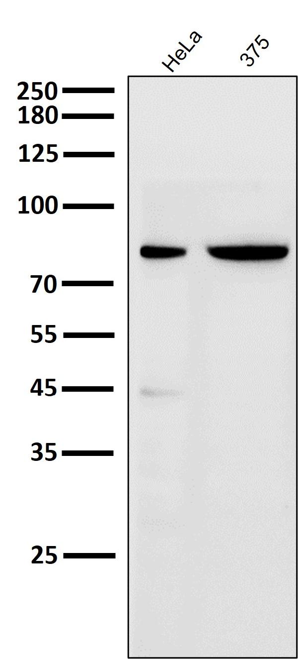 1 - Anti-Cleaved PARP PARP1 Rabbit Monoclonal Antibody ABO14115