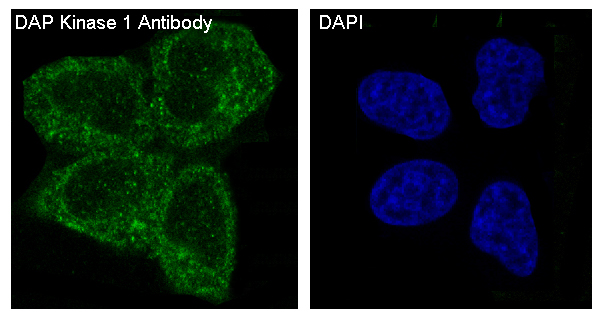 3 - Anti-DAP Kinase 1 DAPK1 Rabbit Monoclonal Antibody ABO14116