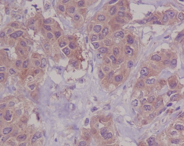 2 - Anti-DAP Kinase 1 DAPK1 Rabbit Monoclonal Antibody ABO14116