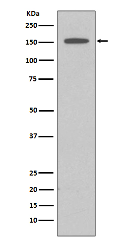 1 - Anti-DAP Kinase 1 DAPK1 Rabbit Monoclonal Antibody ABO14116