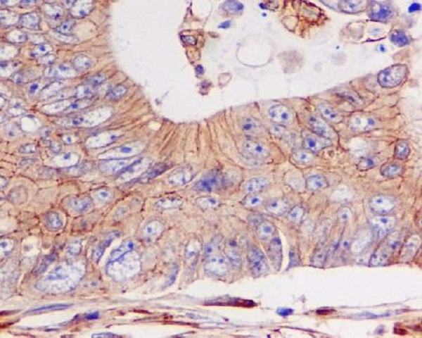 2 - Anti-pan Cadherin 1 CDH1 Rabbit Monoclonal Antibody ABO14117