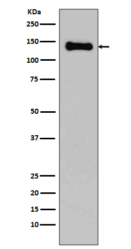 1 - Anti-pan Cadherin 1 CDH1 Rabbit Monoclonal Antibody ABO14117