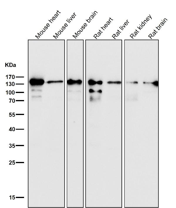1 - Anti-pan Cadherin 1 CDH1 Rabbit Monoclonal Antibody ABO14117