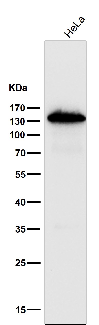 1 - Anti-pan Cadherin 1 CDH1 Rabbit Monoclonal Antibody ABO14117