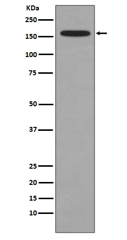 1 - Anti-KMT4 / Dot1L Rabbit Monoclonal Antibody ABO14118
