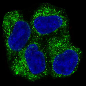3 - Anti-AMPK alpha 1 PRKAA1 Rabbit Monoclonal Antibody ABO14119