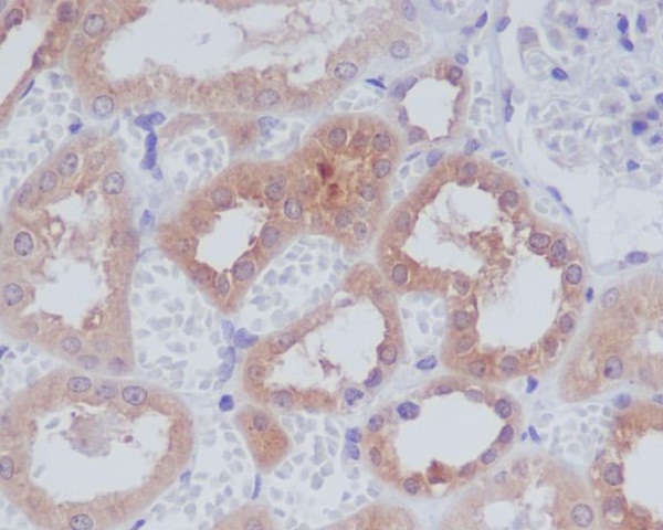 2 - Anti-AMPK alpha 1 PRKAA1 Rabbit Monoclonal Antibody ABO14119