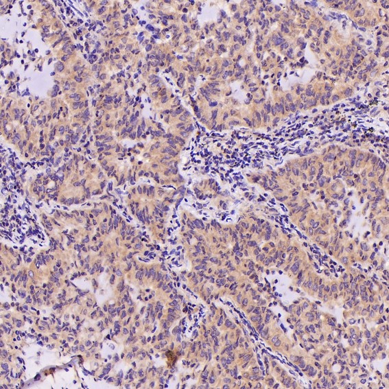 2 - Anti-AMPK alpha 1 PRKAA1 Rabbit Monoclonal Antibody ABO14119