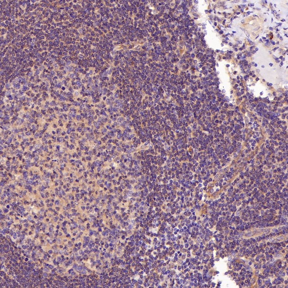 2 - Anti-AMPK alpha 1 PRKAA1 Rabbit Monoclonal Antibody ABO14119