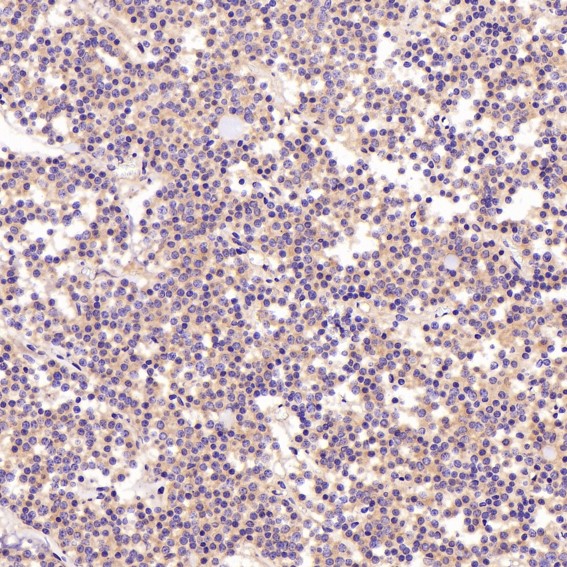 2 - Anti-AMPK alpha 1 PRKAA1 Rabbit Monoclonal Antibody ABO14119