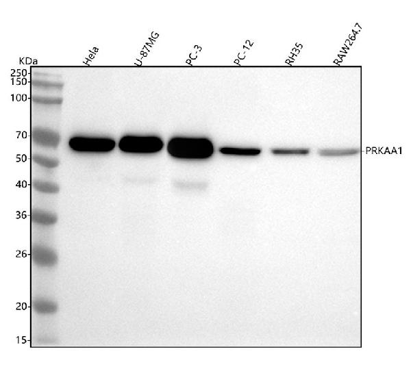 1 - Anti-AMPK alpha 1 PRKAA1 Rabbit Monoclonal Antibody ABO14119