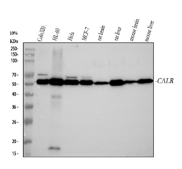 1 - Anti-Calreticulin Rabbit Monoclonal Antibody ABO14120