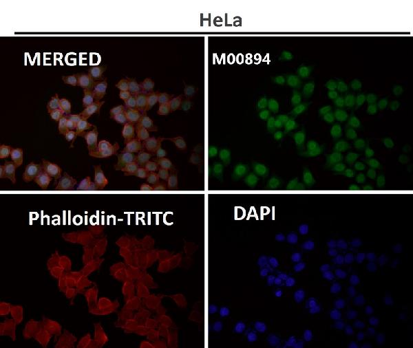 1 - Anti-Calreticulin Rabbit Monoclonal Antibody ABO14120