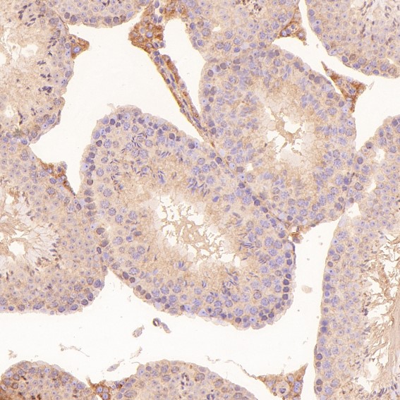 2 - Anti-Calreticulin Rabbit Monoclonal Antibody ABO14120