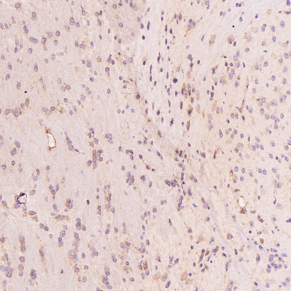 2 - Anti-Calreticulin Rabbit Monoclonal Antibody ABO14120