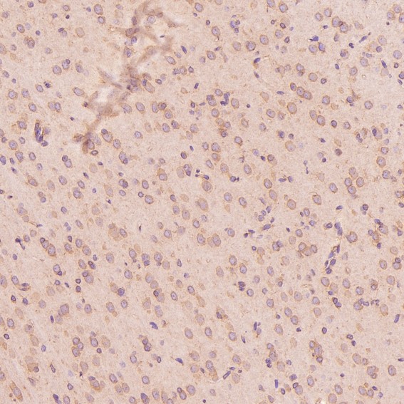 2 - Anti-Calreticulin Rabbit Monoclonal Antibody ABO14120