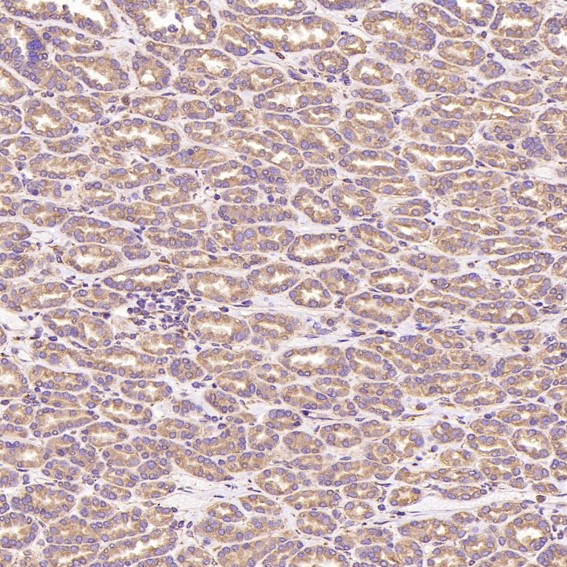 2 - Anti-Calreticulin Rabbit Monoclonal Antibody ABO14120
