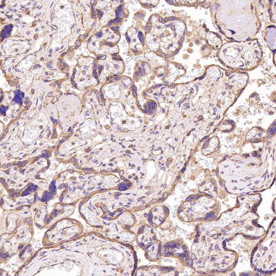 2 - Anti-Calreticulin Rabbit Monoclonal Antibody ABO14120
