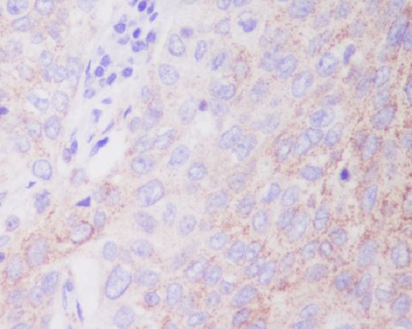 2 - Anti-Hexokinase 1 HK1 Rabbit Monoclonal Antibody ABO14121