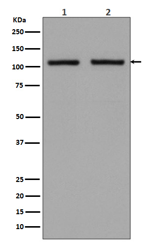 1 - Anti-Hexokinase 1 HK1 Rabbit Monoclonal Antibody ABO14121