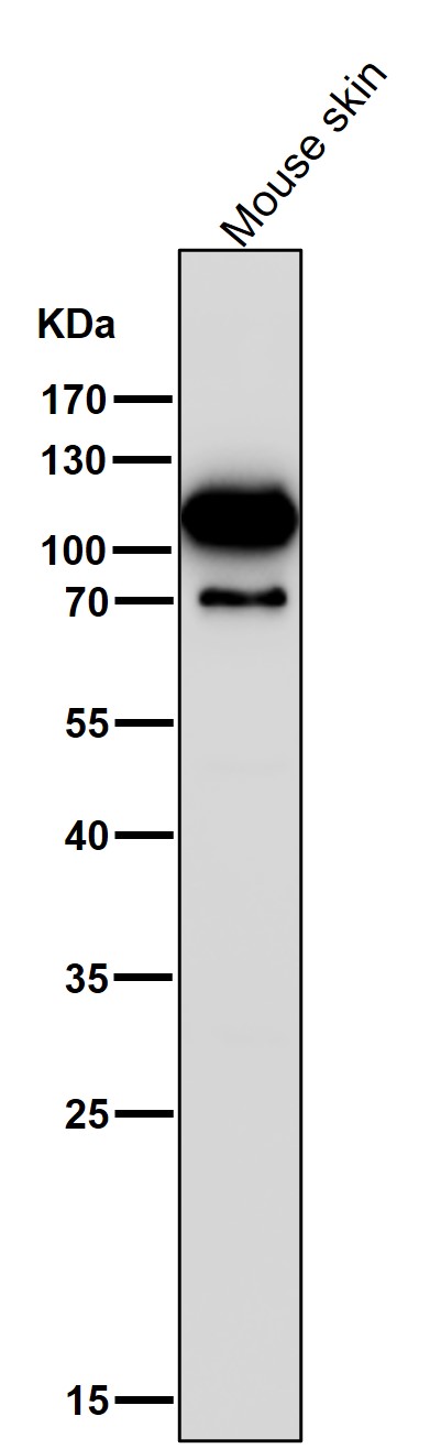 1 - Anti-Hexokinase 1 HK1 Rabbit Monoclonal Antibody ABO14121
